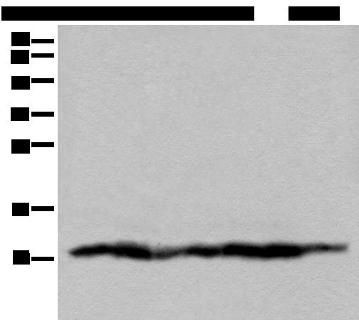 UQCRQ Antibody - Western blot analysis of 293T cell lysates  using UQCRQ Polyclonal Antibody at dilution of 1:450