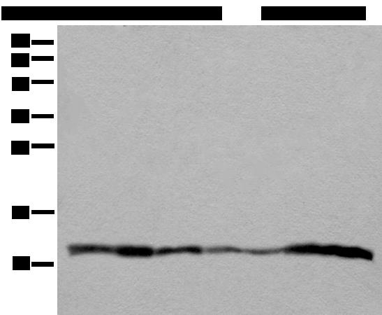 UQCRQ Antibody - Western blot analysis of 293T A549 Hela and 231 cell Human placenta tissue HEPG2 cell Human fetal liver tissue lysates  using UQCRQ Polyclonal Antibody at dilution of 1:400