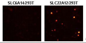 URAT1 / SLC22A12 Antibody