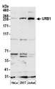 URB1 Antibody - Detection of human URB1 by western blot. Samples: Whole cell lysate (50 µg) from HeLa, HEK293T, and Jurkat cells prepared using NETN lysis buffer. Antibody: Affinity purified rabbit anti-URB1 antibody used for WB at 1 µg/ml. Detection: Chemiluminescence with an exposure time of 3 minutes.
