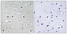 URB1 Antibody - Peptide - + Immunohistochemistry analysis of paraffin-embedded human brain tissue using URB1 antibody.