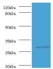 ureA / Urease Alpha Antibody - western blot Western blot. All lanes: Urease subunit alpha antibody at 2 ug/ml+Helicobacter pylori bacteria liquid. Secondary antibody: Goat polyclonal to rabbit at 1:10000 dilution. Predicted band size: 27 kDa. Observed band size: 27 kDa.  This image was taken for the unconjugated form of this product. Other forms have not been tested.