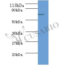 ureB / Urease Beta Antibody - Western blot. All lanes: Urease subunit antibody at 2 ug/ml+293T whole cell lysate. Secondary antibody: Goat polyclonal to Rabbit IgG at 1:10000 dilution. Predicted band size: 62 kDa. Observed band size: 62 kDa.  This image was taken for the unconjugated form of this product. Other forms have not been tested.