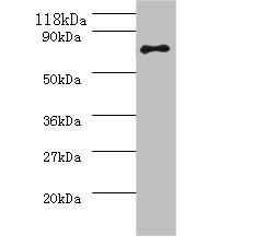 ureB / Urease Beta Antibody - Western blot All lanes: Urease subunit antibody at 2µg/ml + 293T whole cell lysate Secondary Goat polyclonal to rabbit IgG at 1/10000 dilution Predicted band size: 62 kDa Observed band size: 62 kDa