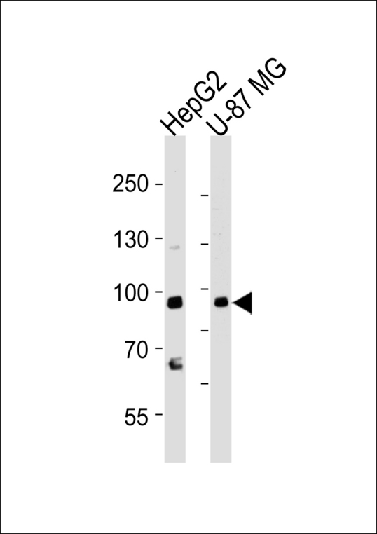 URG4 / URGCP Antibody - Western blot of lysates from HepG2, U-87 MG cell line (from left to right), using URG4 Antibody. Antibody was diluted at 1:1000 at each lane. A goat anti-rabbit IgG H&L (HRP) at 1:5000 dilution was used as the secondary antibody. Lysates at 35ug per lane.
