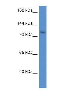 URG4 / URGCP Antibody - URGCP / URG4 antibody Western blot of Mouse Heart lysate. Antibody concentration 1 ug/ml. This image was taken for the unconjugated form of this product. Other forms have not been tested.
