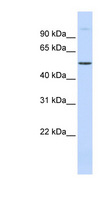 URI1 / NNX3 Antibody - C19orf2 / NNX3 antibody Western blot of Fetal Muscle lysate. This image was taken for the unconjugated form of this product. Other forms have not been tested.