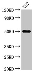 URI1 / NNX3 Antibody - Positive Western Blot detected in U87 whole cell lysate. All lanes: URI1 antibody at 5.3 µg/ml Secondary Goat polyclonal to rabbit IgG at 1/50000 dilution. Predicted band size: 60, 52, 57, 54 KDa. Observed band size: 50 KDa