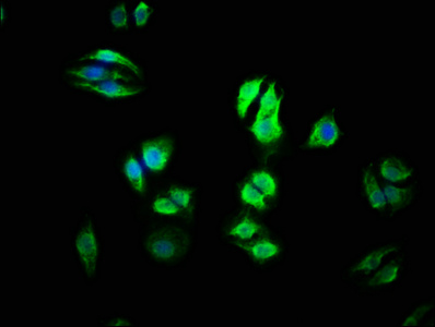 URI1 / NNX3 Antibody - Immunofluorescence staining of HepG2 cells with URI1 Antibody at 1:100, counter-stained with DAPI. The cells were fixed in 4% formaldehyde, permeabilized using 0.2% Triton X-100 and blocked in 10% normal Goat Serum. The cells were then incubated with the antibody overnight at 4°C. The secondary antibody was Alexa Fluor 488-congugated AffiniPure Goat Anti-Rabbit IgG(H+L).