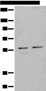 URI1 / NNX3 Antibody - Western blot analysis of 293T cell lysates  using URI1 Polyclonal Antibody at dilution of 1:450