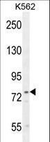 UROC1 Antibody - UROC1 Antibody western blot of K562 cell line lysates (35 ug/lane). The UROC1 antibody detected the UROC1 protein (arrow).