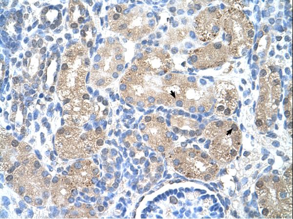 UROD Antibody - UROD antibody ARP41724_T100-NP_000365-UROD(uroporphyrinogen decarboxylase) Antibody was used in IHC to stain formalin-fixed, paraffin-embedded human kidney.  This image was taken for the unconjugated form of this product. Other forms have not been tested.