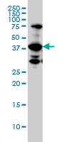 UROD Antibody - UROD monoclonal antibody (M01A), clone 1G4. Western Blot analysis of UROD expression in MCF-7.