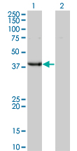 UROD Antibody - Western Blot analysis of UROD expression in transfected 293T cell line by UROD monoclonal antibody (M01A), clone 1G4.Lane 1: UROD transfected lysate(40.787 KDa).Lane 2: Non-transfected lysate.