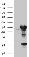 UROD Antibody - HEK293T cells were transfected with the pCMV6-ENTRY control. (Left lane) or pCMV6-ENTRY UROD. (Right lane) cDNA for 48 hrs and lysed. Equivalent amounts of cell lysates. (5 ug per lane) were separated by SDS-PAGE and immunoblotted with anti-UROD. (1:2000)