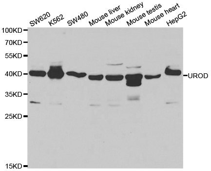 UROD Antibody - Western blot analysis of extracts of various cell lines.
