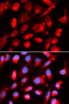 UROD Antibody - Immunofluorescence analysis of U20S cells.