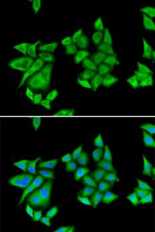 UROD Antibody - Immunofluorescence analysis of U2OS cells.