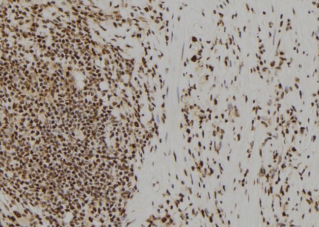 UROD Antibody - 1:100 staining human gastric tissue by IHC-P. The sample was formaldehyde fixed and a heat mediated antigen retrieval step in citrate buffer was performed. The sample was then blocked and incubated with the antibody for 1.5 hours at 22°C. An HRP conjugated goat anti-rabbit antibody was used as the secondary.