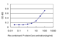 UROS Antibody - Detection limit for recombinant GST tagged UROS is approximately 1 ng/ml as a capture antibody.