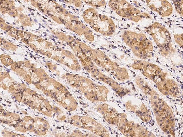 UROS Antibody - Immunochemical staining of human UROS in human stomach with rabbit polyclonal antibody at 1:100 dilution, formalin-fixed paraffin embedded sections.