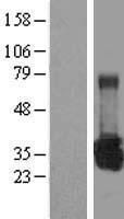 UROS Protein - Western validation with an anti-DDK antibody * L: Control HEK293 lysate R: Over-expression lysate