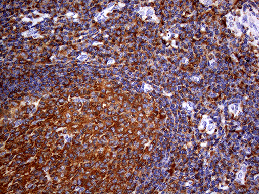 URP2 / FERMT3 Antibody - Immunohistochemical staining of paraffin-embedded Human tonsil within the normal limits using anti-FERMT3 mouse monoclonal antibody. (Heat-induced epitope retrieval by 1mM EDTA in 10mM Tris buffer. (pH8.5) at 120°C for 3 min. (1:150)