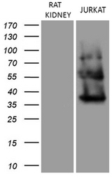 URP2 / FERMT3 Antibody - Western blot analysis of extracts. (35ug) from cell line and. (15ug) tissue lysate by using anti-FERMT3 monoclonal antibody. (Jurkat: human;Kidney: rat)."" ""(1:500)