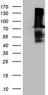 URP2 / FERMT3 Antibody - HEK293T cells were transfected with the pCMV6-ENTRY control. (Left lane) or pCMV6-ENTRY FERMT3. (Right lane) cDNA for 48 hrs and lysed. Equivalent amounts of cell lysates. (5 ug per lane) were separated by SDS-PAGE and immunoblotted with anti-FERMT3. (1:2000)