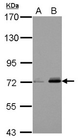 URP2 / FERMT3 Antibody - Sample (30 ug of whole cell lysate) A: Jurkat B: Raji 7.5% SDS PAGE FERMT3 / URP2 antibody diluted at 1:1000