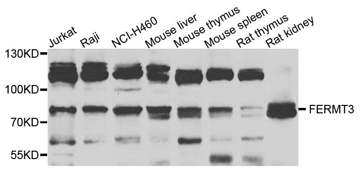 URP2 / FERMT3 Antibody - Western blot analysis of extracts of various cells.