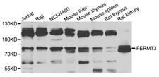 URP2 / FERMT3 Antibody - Western blot analysis of extracts of various cells.