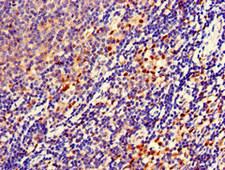 URP2 / FERMT3 Antibody - Immunohistochemistry of paraffin-embedded human lymph node tissue at dilution of 1:100
