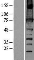 URP2 / FERMT3 Protein - Western validation with an anti-DDK antibody * L: Control HEK293 lysate R: Over-expression lysate