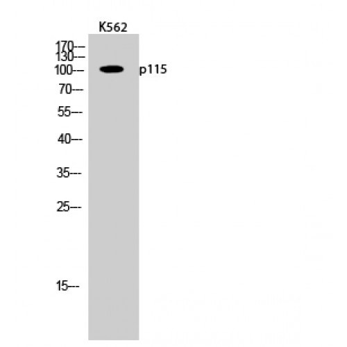 US01 / p115 Antibody - Western blot of p115 antibody