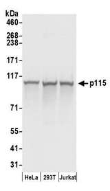 US01 / p115 Antibody - Detection of human p115 by western blot. Samples: Whole cell lysate (50 µg) from HeLa, HEK293T, and Jurkat cells prepared using NETN lysis buffer. Antibodies: Affinity purified rabbit anti-p115 antibody used for WB at 0.1 µg/ml. Detection: Chemiluminescence with an exposure time of 1 second.