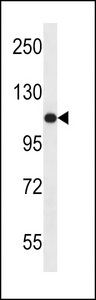 US01 / p115 Antibody - USO1 Antibody western blot of ZR-75-1 cell line lysates (35 ug/lane). The USO1 antibody detected the USO1 protein (arrow).