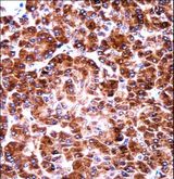 US01 / p115 Antibody - USO1 Antibody immunohistochemistry of formalin-fixed and paraffin-embedded human pancreas tissue followed by peroxidase-conjugated secondary antibody and DAB staining.