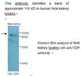 US01 / p115 Antibody
