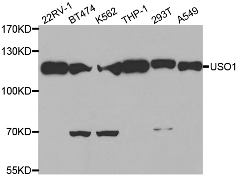 US01 / p115 Antibody - Western blot analysis of extracts of various cell lines.