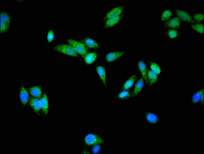 US01 / p115 Antibody - Immunofluorescent analysis of HepG2 cells at a dilution of 1:100 and Alexa Fluor 488-congugated AffiniPure Goat Anti-Rabbit IgG(H+L)