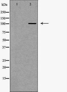 US01 / p115 Antibody - Western blot analysis of extracts of mouse fetal kidney tissue lysate using USO1 antibody. The lane on the left is treated with the antigen-specific peptide.