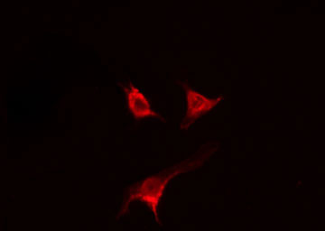 US01 / p115 Antibody - Staining MCF-7 cells by IF/ICC. The samples were fixed with PFA and permeabilized in 0.1% Triton X-100, then blocked in 10% serum for 45 min at 25°C. The primary antibody was diluted at 1:200 and incubated with the sample for 1 hour at 37°C. An Alexa Fluor 594 conjugated goat anti-rabbit IgG (H+L) antibody, diluted at 1/600, was used as secondary antibody.