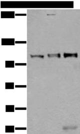 US01 / p115 Antibody - Western blot analysis of Mouse testis tissue Jurkat and A549 cell lysates  using USO1 Polyclonal Antibody at dilution of 1:350