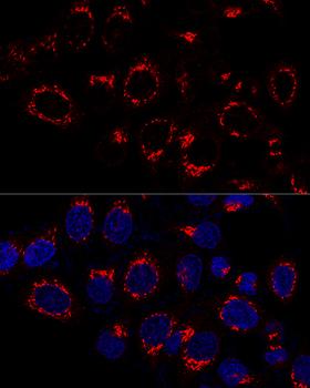 US01 / p115 Antibody - Confocal immunofluorescence analysis of HeLa cells using USO1 Polyclonal Antibody at dilution of 1:50.Blue: DAPI for nuclear staining.