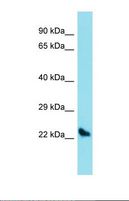 USAG1 / SOSTDC1 Antibody - Western blot of Mouse Liver. Sostdc1 antibody dilution 1.0 ug/ml.  This image was taken for the unconjugated form of this product. Other forms have not been tested.