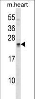USAG1 / SOSTDC1 Antibody - SOSTDC1 Antibody western blot of mouse heart tissue lysates (35 ug/lane). The SOSTDC1 antibody detected the SOSTDC1 protein (arrow).