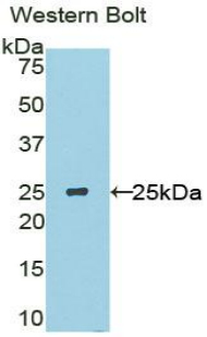 USAG1 / SOSTDC1 Antibody - Western blot of recombinant USAG1 / SOSTDC1.  This image was taken for the unconjugated form of this product. Other forms have not been tested.