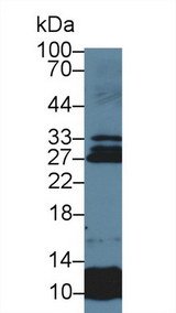 USAG1 / SOSTDC1 Antibody - Western Blot; Sample: Human Lung lysate; Primary Ab: 5µg/ml Rabbit Anti-Human SOSTDC1 Antibody Second Ab: 0.2µg/mL HRP-Linked Caprine Anti-Rabbit IgG Polyclonal Antibody