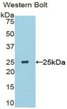USAG1 / SOSTDC1 Antibody - Western blot of recombinant USAG1 / SOSTDC1.  This image was taken for the unconjugated form of this product. Other forms have not been tested.